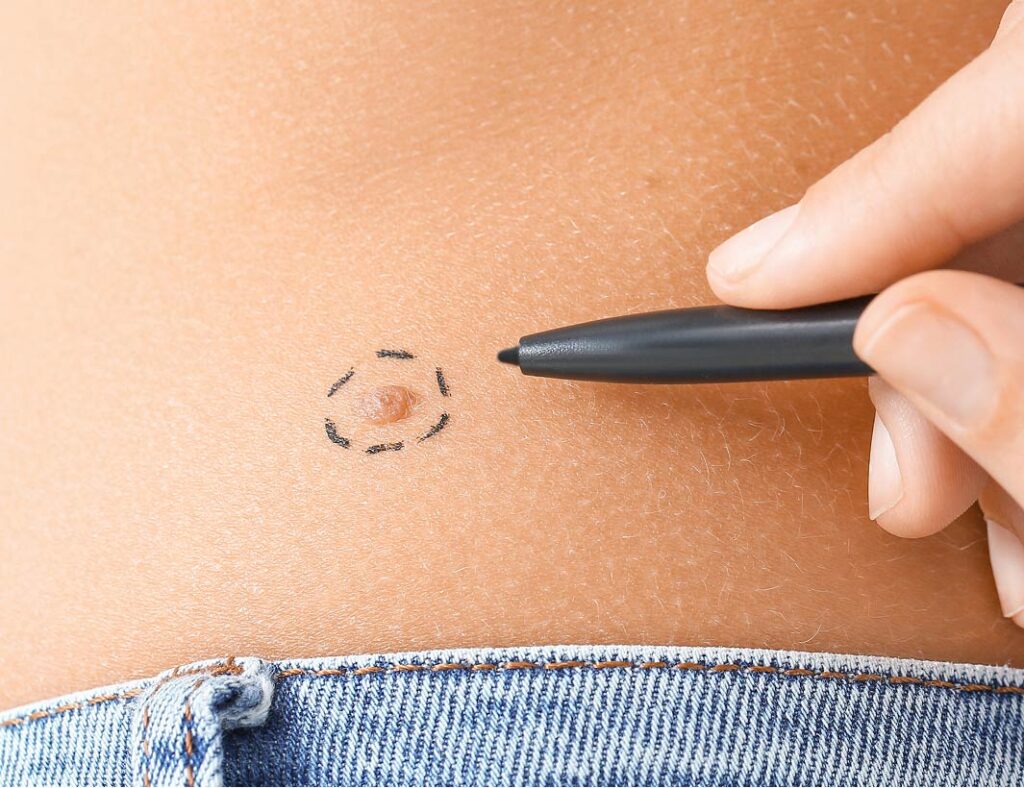dermatologia